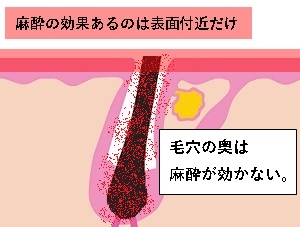 EEт̖ьƖ̌ʂ͈