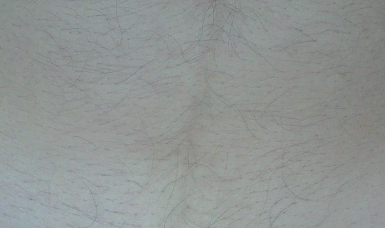 六條かげり、腹毛の硬毛化の写真