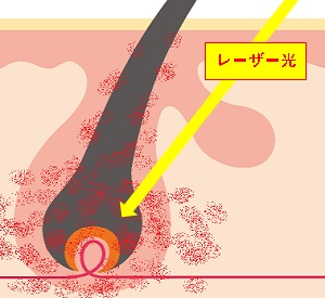 [U[Eт̎dgݐ}