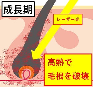 ]̃[U[E